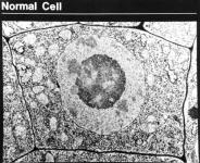 Normal Cell